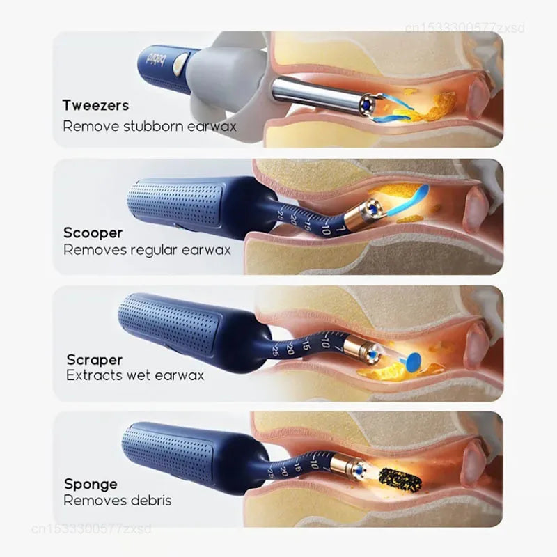 2025 Bebird EarSight Plus I35R R37R D39R Smart Visual Earpick Ear Camera Bendable All-in-1 Ear Rod Earwax Removal Kits Tools